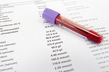 Tubo de coleta de sangue sobre um laudo laboratorial